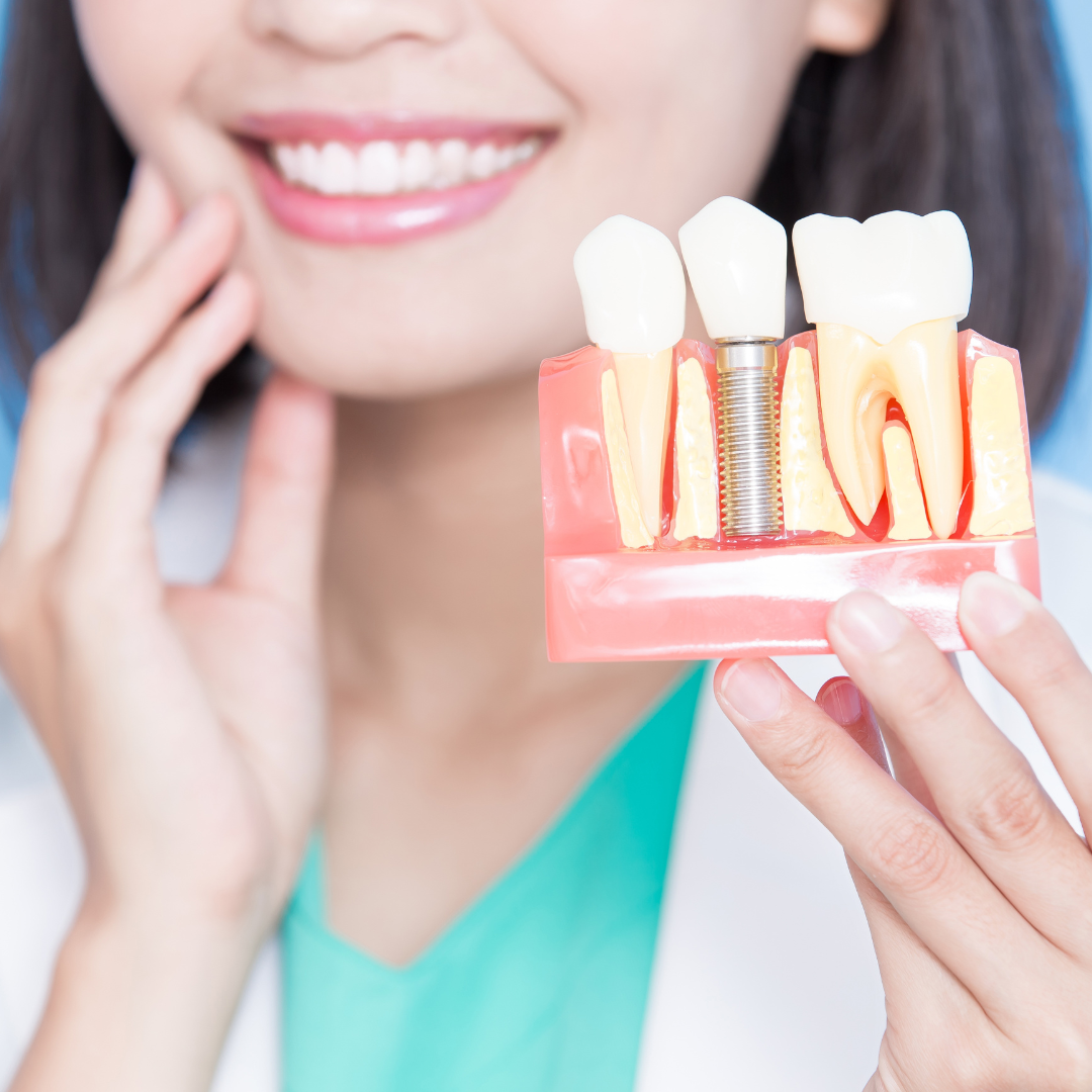 Understanding Dental Implants: A Comprehensive Guide to Restoring Your Smile